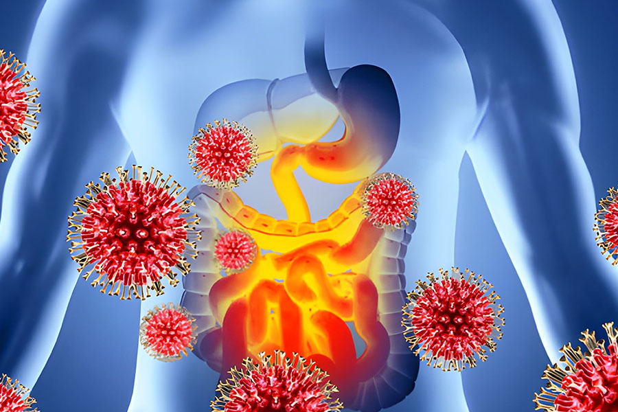 Colorectal Cancer Symptoms